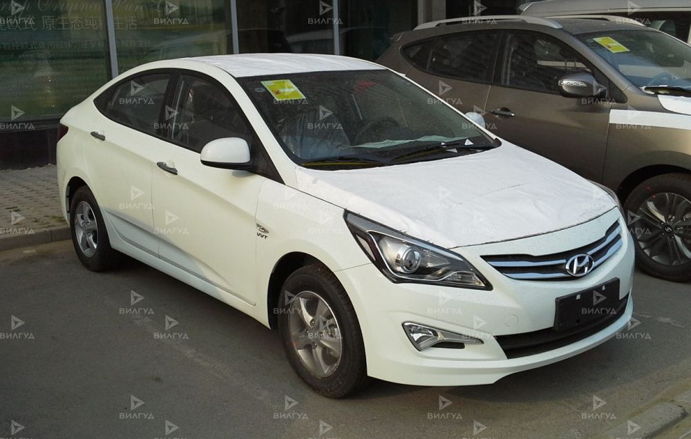 Замена прокладки клапанной крышки Hyundai Verna в Уфе